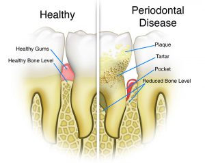 hygiene & gum care