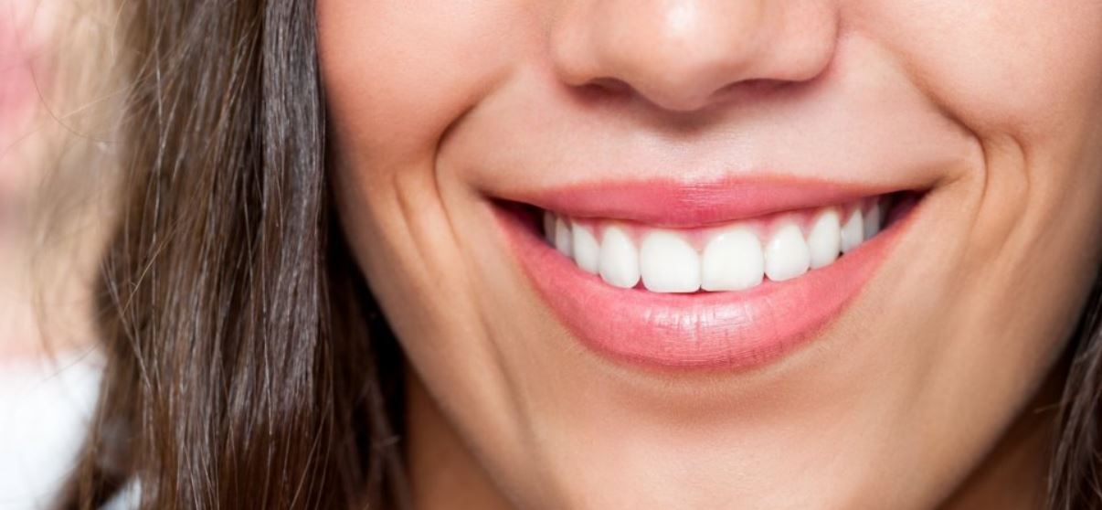 ultra-thin veneers